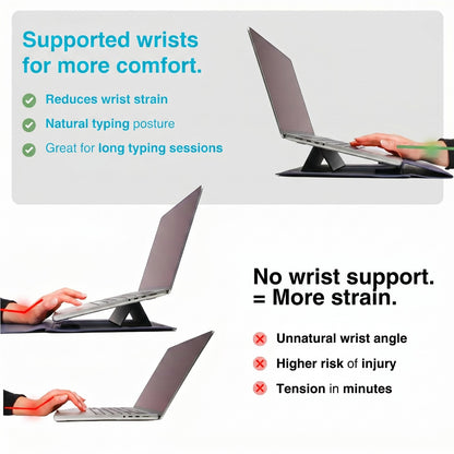 Omexa™ ERGO SLEEVE – 4-in-1 Ergonomic Workstation Set